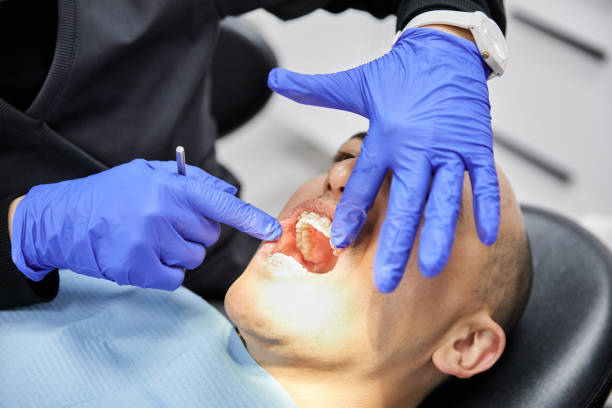 Best Emergency Dental Care for Broken or Chipped Teeth in Cupertino, CA